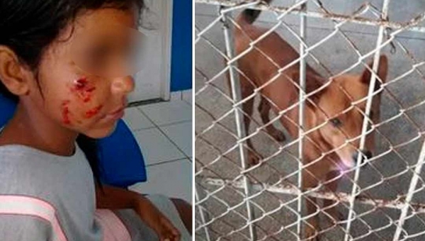 Cachorro abandonado ataca criança de 8 anos em Cruzeiro do Sul